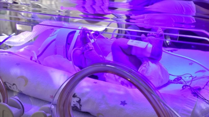 'Prematüre bebekler derneşik izlem edilmeyen hamilelikten doğuyor' uyarısı
